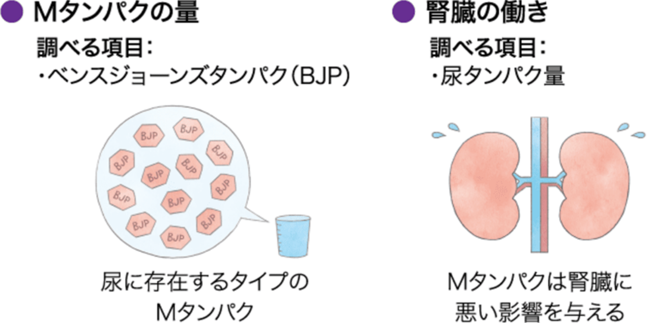 尿検査