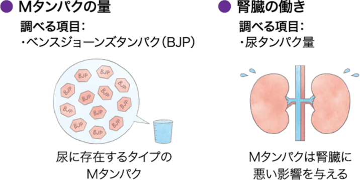 尿検査