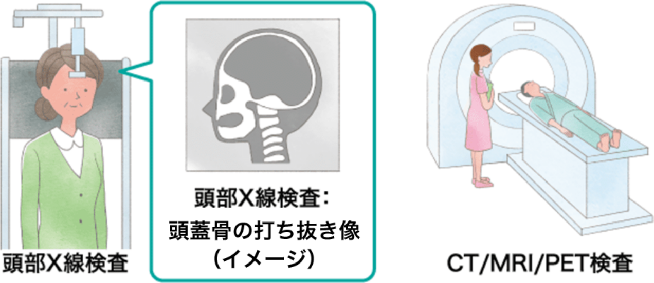 画像検査(レントゲン、CT、MRIなど)