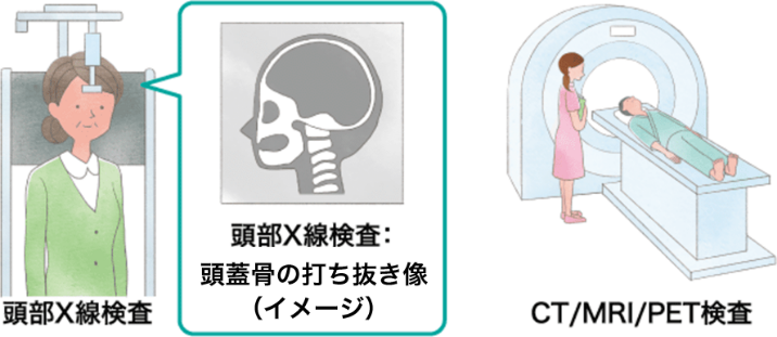 画像検査(レントゲン、CT、MRIなど)