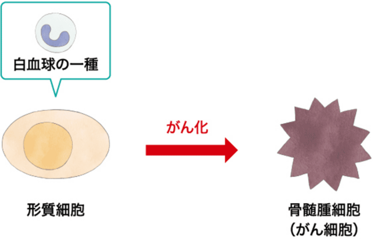 白血球の一つである形質細胞ががん細胞に変わる