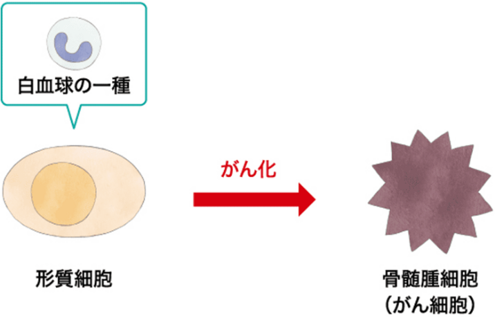 白血球の一つである形質細胞ががん細胞に変わる