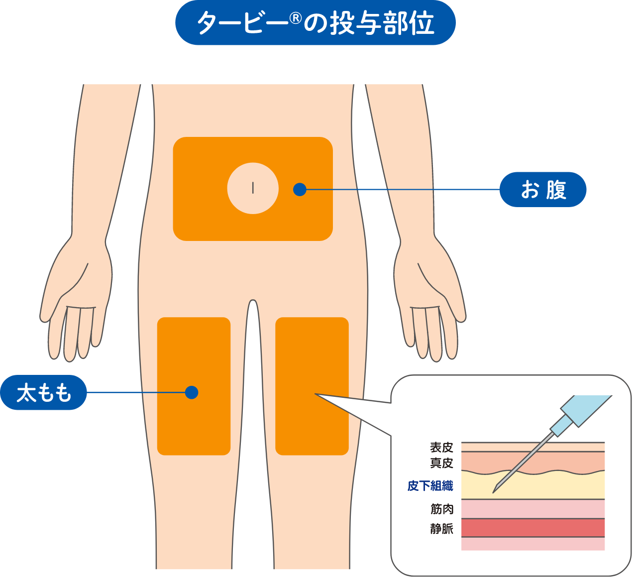 タービー®の投与方法