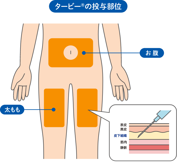 タービー®の投与方法