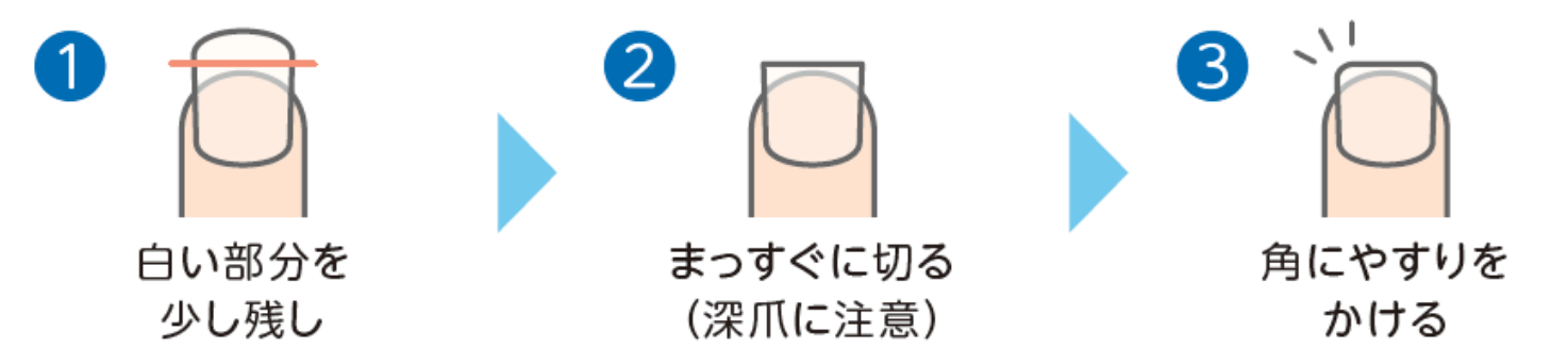 爪の切り方の例