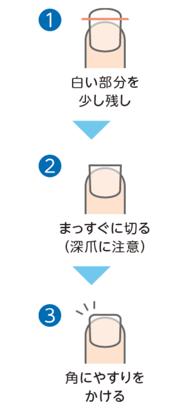爪の切り方の例