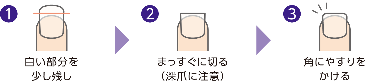 爪の切り方の例