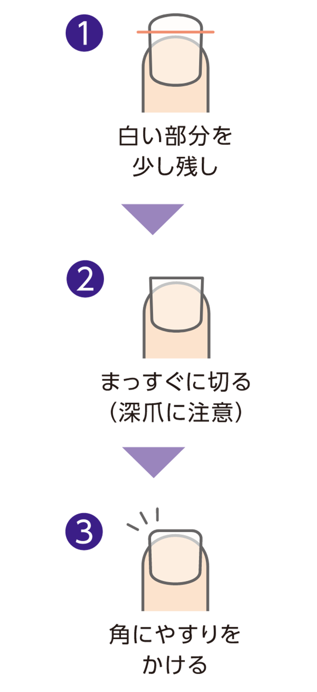 爪の切り方の例